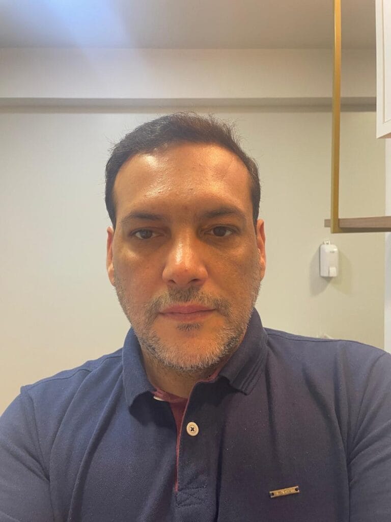 Médico alerta sobre os cuidados com acidentes durante as festas de fim de semana